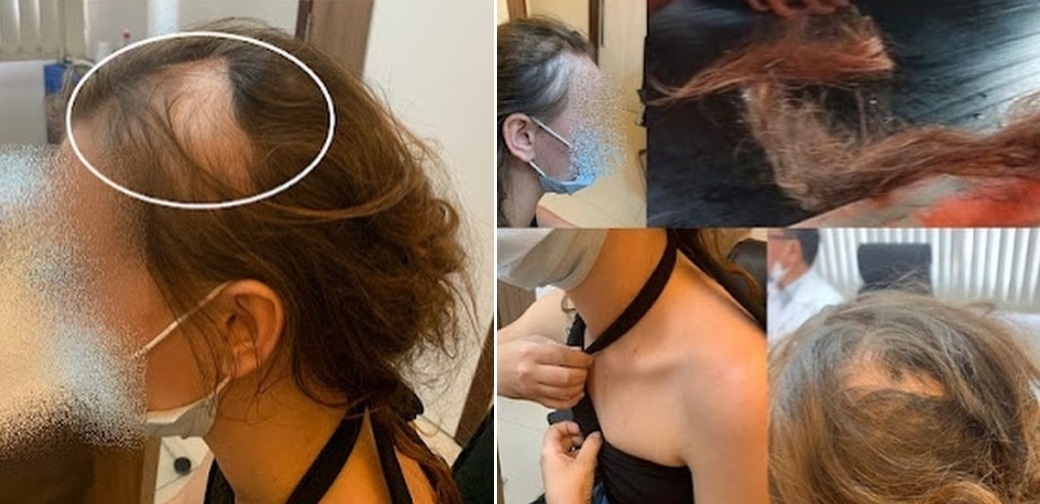 Agressões ficaram pelo corpo da vítima...